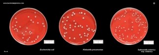 enteric bacteria